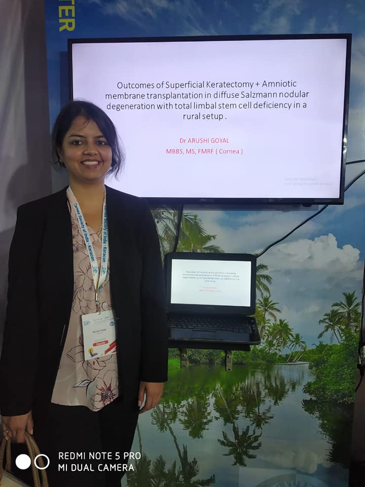 Keracon 2019 — Aapulki Eye Care events gallery